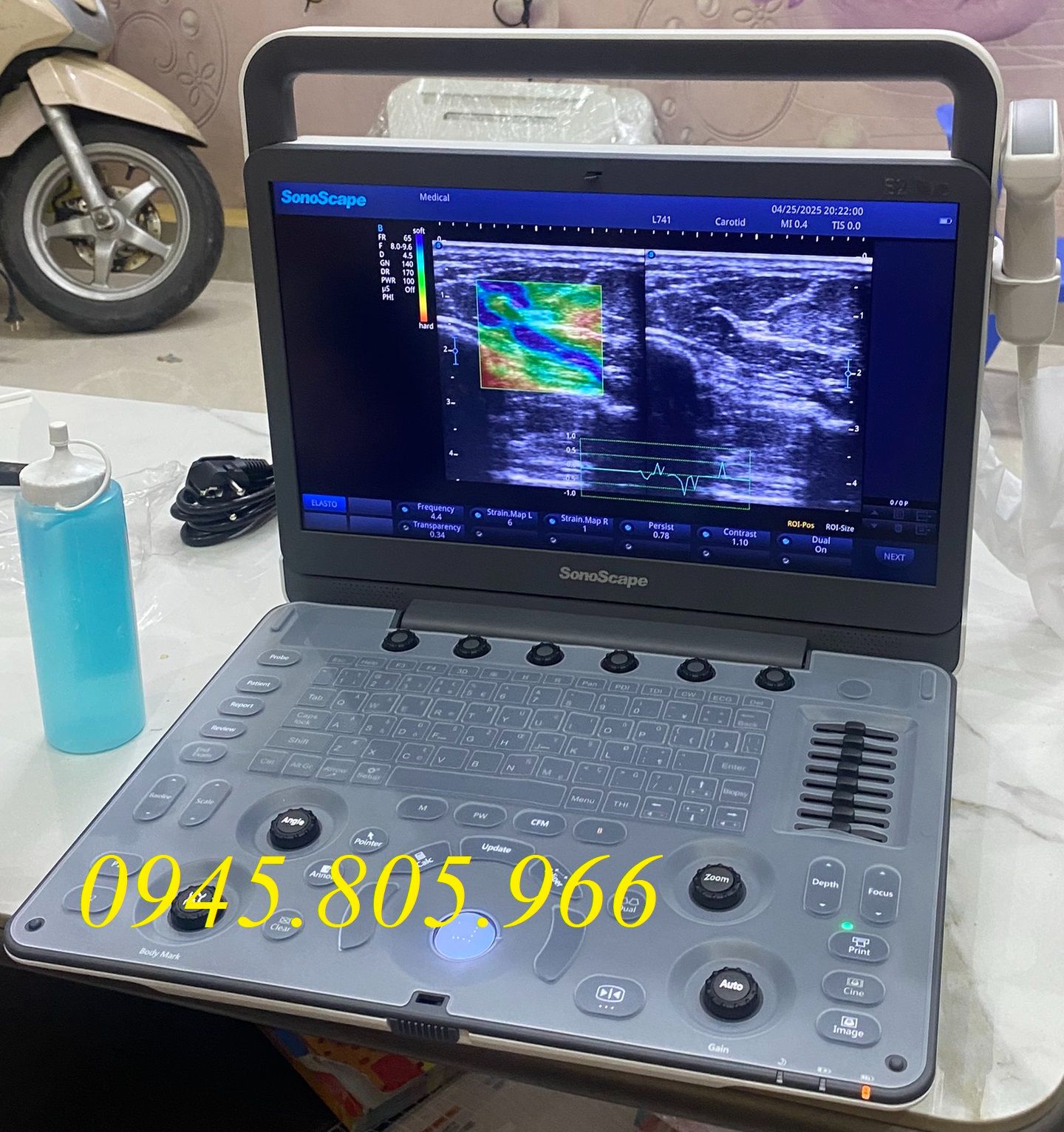 Máy siêu âm cơ xương khớp